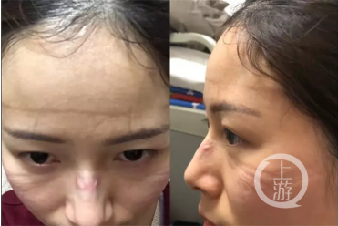 1586873330863087860.png QQ截图20200229164753.png