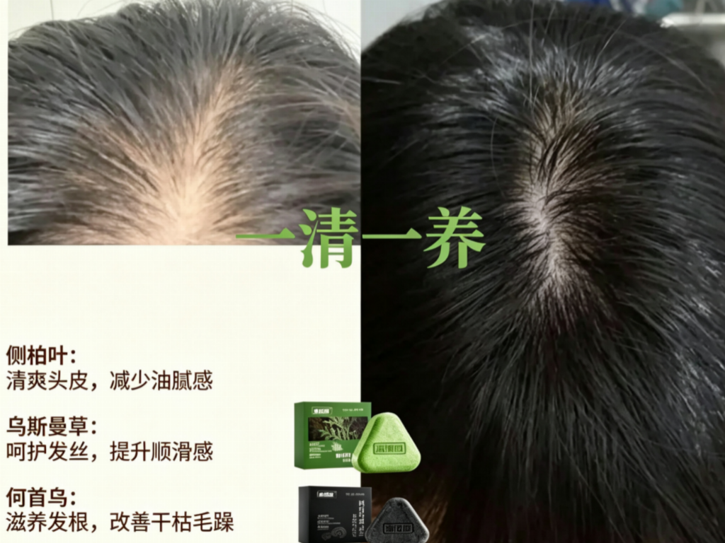 2026年草本植萃洗发皂品牌自测分享：十个品牌控油防脱去屑完整测评！